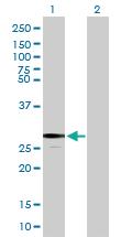 Anti-FKBP7 Mouse Polyclonal Antibody