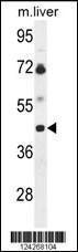 Anti-B3GNT5 Rabbit Polyclonal Antibody (AP (Alkaline Phosphatase))