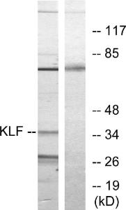 Western blot analysis of lysates from Jurkat cells, treated with serum 20% 15' using Anti-KLF Antibody. The right hand lane represents a negative control, where the antibody is blocked by the immunising peptide