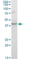 Anti-GNRHR2 Mouse Monoclonal Antibody [clone: 4A5]