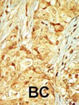 Anti-MOK Rabbit Polyclonal Antibody (AP (Alkaline Phosphatase))