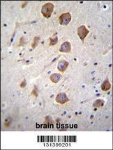 Anti-KCNRG Rabbit Polyclonal Antibody (PE (Phycoerythrin))