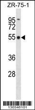 Anti-FBXO5 Rabbit Polyclonal Antibody (FITC (Fluorescein Isothiocyanate))