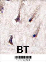 Anti-PKC beta2 Rabbit Polyclonal Antibody (PE (Phycoerythrin))