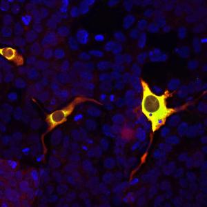 Immunofluorescent analysis of HEK293 cells transfected with a construct including the C-terminal 250 amino acids of S