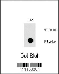 Anti-RAF1 Rabbit Polyclonal Antibody