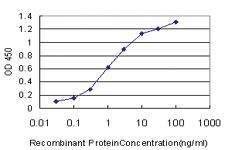 Anti-AFF4 Mouse Monoclonal Antibody [clone: 2E12]