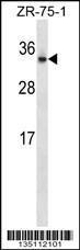 Anti-OTUB2 Rabbit Polyclonal Antibody (APC (Allophycocyanin))