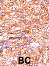 Anti-DUSP10 Rabbit Polyclonal Antibody (FITC (Fluorescein))