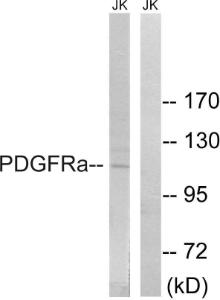 Western blot analysis of lysates from Jurkat cells using Anti-PDGFRa Antibody. The right hand lane represents a negative control, where the antibody is blocked by the immunising peptide