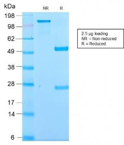 SDS-PAGE analysis of Anti-Kappa Light Chain Antibody [KLC2886R] under non-reduced and reduced conditions; showing intact IgG and intact heavy and light chains, respectively. SDS-PAGE analysis confirms the integrity and purity of the antibody.