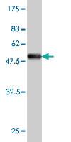 Anti-VSNL1 Mouse Monoclonal Antibody [clone: 2F1-E3]