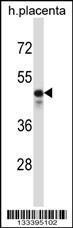 Anti-KCNS2 Rabbit Polyclonal Antibody (AP (Alkaline Phosphatase))