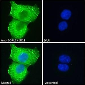 Anti-SORL1 Antibody (A83763) - Immunofluorescence analysis of paraformaldehyde fixed A431 cells, permeabilized with 0.15% Triton. Primary incubation 1hr (10µg/ml) followed by Alexa Fluor 488 secondary antibody (2µg/ml), showing cytoplasmic with endosome staining.