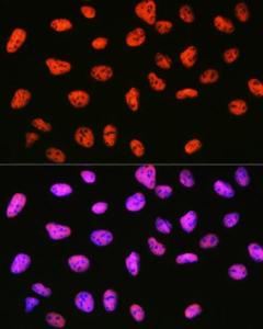 Immunofluorescence analysis of U-2 OS cells using Anti-mSin3A Antibody [ARC0745] (A309217) at a dilution of 1:100 (40X lens). DAPI was used to stain the cell nuclei (blue)