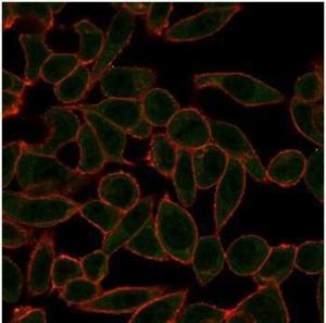 Anti-ETS2 Mouse Monoclonal Antibody [clone: PCRP-ETS2-1D9]