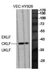 Western blot analysis of various cells using Anti-KLF Antibody