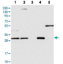 Anti-LACTB2 Rabbit Polyclonal Antibody