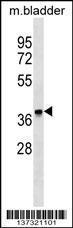 Anti-FBXO8 Rabbit Polyclonal Antibody (AP (Alkaline Phosphatase))