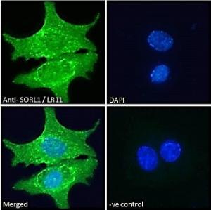 Anti-SORL1 Antibody (A83763) - Immunofluorescence analysis of paraformaldehyde fixed HepG2 cells, permeabilized with 0.15% Triton. Primary incubation 1hr (10µg/ml) followed by Alexa Fluor 488 secondary antibody (2µg/ml), showing cytoplasmic/endosome, membrane and nuclear staining.