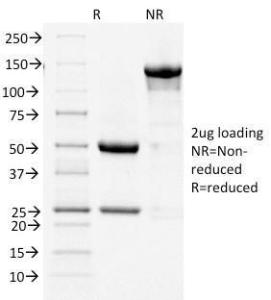 SDS-PAGE analysis of Anti-COX2 Antibody [COX2/1941] under non-reduced and reduced conditions; showing intact IgG and intact heavy and light chains, respectively. SDS-PAGE analysis confirms the integrity and purity of the antibody