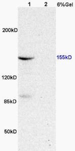 Anti-MAP3K5 Rabbit Polyclonal Antibody