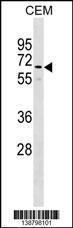 Anti-GOLGA8B Rabbit Polyclonal Antibody (Biotin)