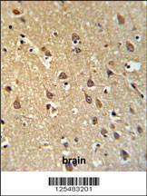 Anti-SPRN Rabbit Polyclonal Antibody (HRP (Horseradish Peroxidase))