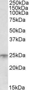 Anti-MSC Antibody (A83764) (1µg/ml) staining of Human Bone Marrow lysate (35µg protein in RIPA buffer). Primary incubation was 1 hour. Detected by chemiluminescence.