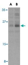 Anti-BCL2L11 Rabbit Polyclonal Antibody