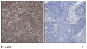 Anti-SMAD3 Rabbit Polyclonal Antibody