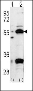 Anti-PDX1 Rabbit Polyclonal Antibody (Biotin)