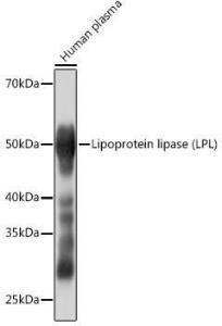 Western blot analysis of extracts of Human plasma, using Anti-Lipoprotein lipase Antibody [ARC0904] (A306319) at 1:1,000 dilution