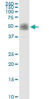 Anti-CD2 Rabbit Polyclonal Antibody