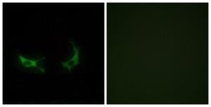 Antibody anti-OR2M3 100 µg