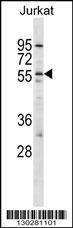 Anti-HCRTR2 Rabbit Polyclonal Antibody (Biotin)