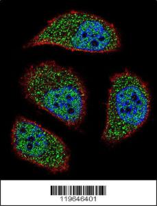 Anti-BNIP3L Rabbit Polyclonal Antibody (APC (Allophycocyanin))