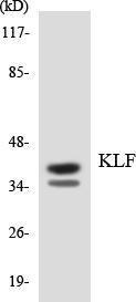 Western blot analysis of the lysates from K562 cells using Anti-KLF Antibody