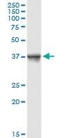 Anti-CD2 Rabbit Polyclonal Antibody