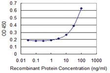 Anti-NPY1R Mouse Monoclonal Antibody [clone: 3A1]