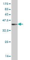 Anti-TRIB3 Mouse Monoclonal Antibody [clone: 3D7]