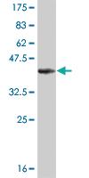 Anti-KAT2B Mouse Monoclonal Antibody [clone: 5E10]