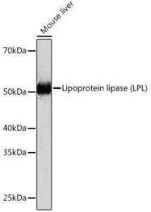 Western blot analysis of extracts of Mouse liver, using Anti-Lipoprotein lipase Antibody [ARC0904] (A306319) at 1:1,000 dilution