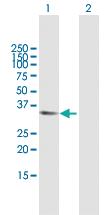 Anti-APBB2 Mouse Polyclonal Antibody