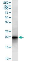 Anti-LZIC Mouse Polyclonal Antibody