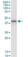 Anti-SNUPN Polyclonal Antibody Pair