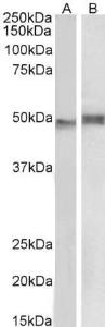 Anti-NCF1 Antibody (A83765) (1 µg/ml) staining of Mouse Thymus (A) and Pig Spleen (B) lysate (35 µg protein in RIPA buffer). Detected by chemiluminescence