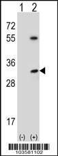 Anti-STK16 Rabbit Polyclonal Antibody (APC (Allophycocyanin))