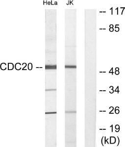 Antibody anti-P55CDC 100 µg