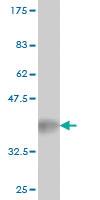 Anti-XIAP Mouse Monoclonal Antibody [clone: 2B3]